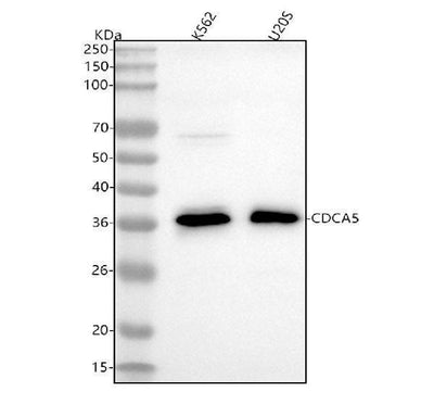 Anti-CDCA5/Sororin Rabbit Monoclonal Antibody Boster Bio