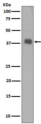 Anti-Synaptophysin SYP Rabbit Monoclonal Antibody Boster Bio
