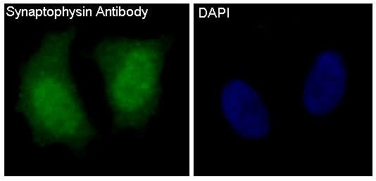 Anti-Synaptophysin SYP Rabbit Monoclonal Antibody Boster Bio
