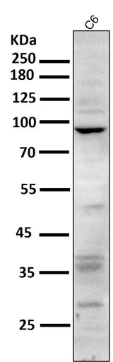 Anti-CD168 HMMR Rabbit Monoclonal Antibody Boster Bio