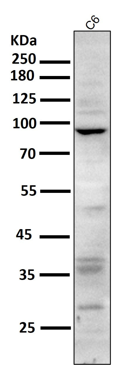Anti-CD168 HMMR Rabbit Monoclonal Antibody Boster Bio