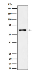Anti-EYA2 Rabbit Monoclonal Antibody Boster Bio
