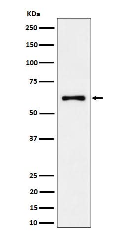 Anti-EYA2 Rabbit Monoclonal Antibody Boster Bio
