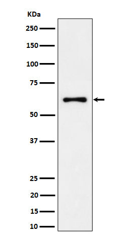 Anti-EYA2 Rabbit Monoclonal Antibody Boster Bio