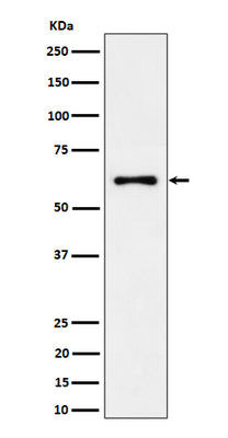 Anti-EYA2 Rabbit Monoclonal Antibody Boster Bio
