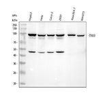 Anti-TAB3 Rabbit Monoclonal Antibody Boster Bio