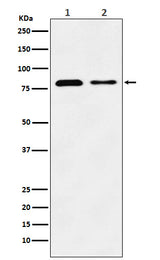 Anti-LIMPII Rabbit Monoclonal Antibody Boster Bio