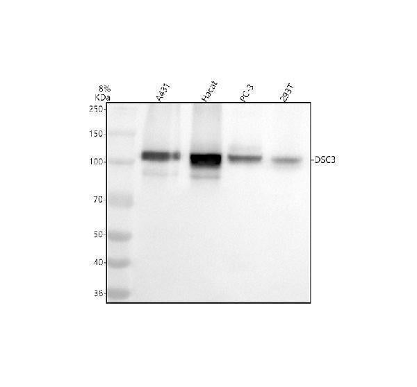 Anti-Desmocollin-3 Rabbit Monoclonal Antibody Boster Bio