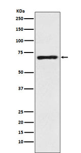 Anti-SLC6A1 / GAT1 Rabbit Monoclonal Antibody Boster Bio