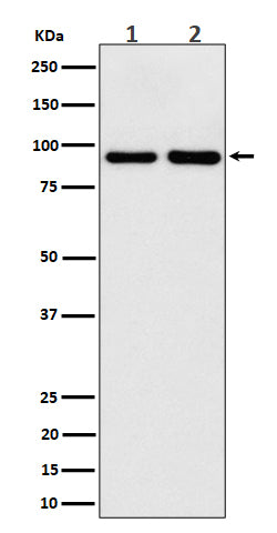 Anti-CSDE1 Rabbit Monoclonal Antibody Boster Bio