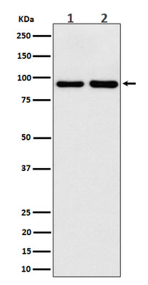 Anti-CSDE1 Rabbit Monoclonal Antibody Boster Bio
