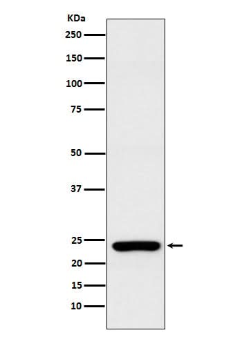 Anti-Rab25 Rabbit Monoclonal Antibody Boster Bio