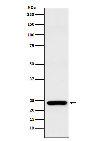 Anti-Rab25 Rabbit Monoclonal Antibody Boster Bio