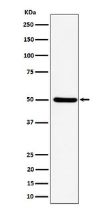 Anti-UBA3 Rabbit Monoclonal Antibody Boster Bio