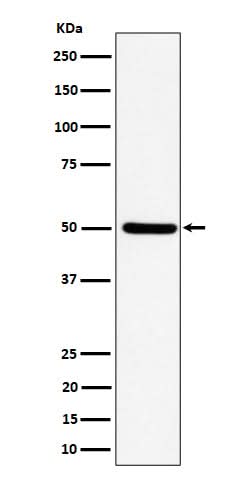 Anti-UBA3 Rabbit Monoclonal Antibody Boster Bio