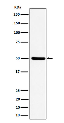 Anti-UBA3 Rabbit Monoclonal Antibody Boster Bio