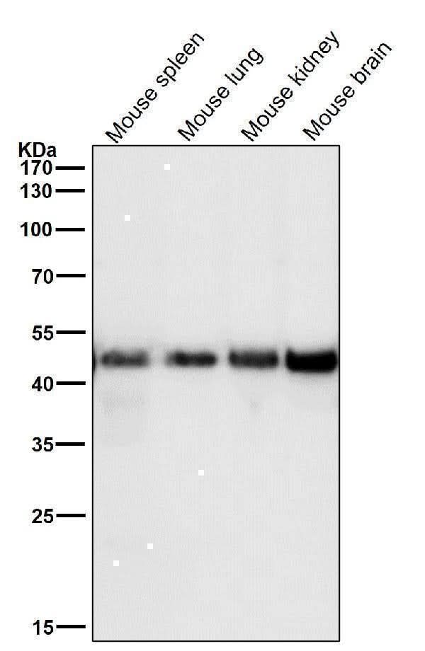 Anti-FDFT1 Monoclonal Antibody Boster Bio