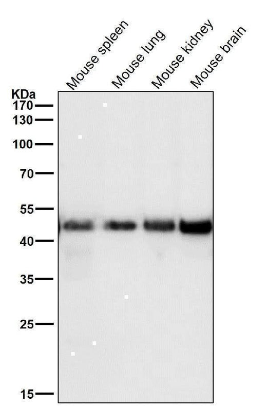Anti-FDFT1 Monoclonal Antibody Boster Bio