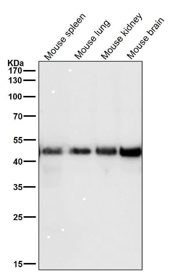 Anti-FDFT1 Monoclonal Antibody Boster Bio