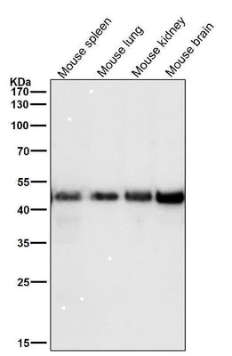 Anti-FDFT1 Monoclonal Antibody Boster Bio
