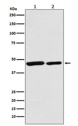 Anti-Citrate synthetase CS Monoclonal Antibody Boster Bio