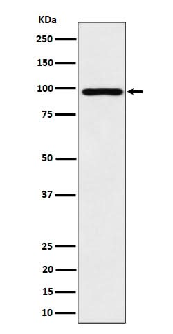 Anti-AKAP 95 Rabbit Monoclonal Antibody Boster Bio