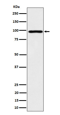 Anti-AKAP 95 Rabbit Monoclonal Antibody Boster Bio