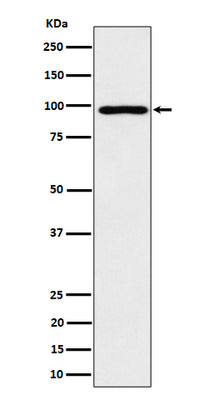 Anti-AKAP 95 Rabbit Monoclonal Antibody Boster Bio