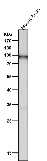 Anti-UBF1 Rabbit Monoclonal Antibody Boster Bio