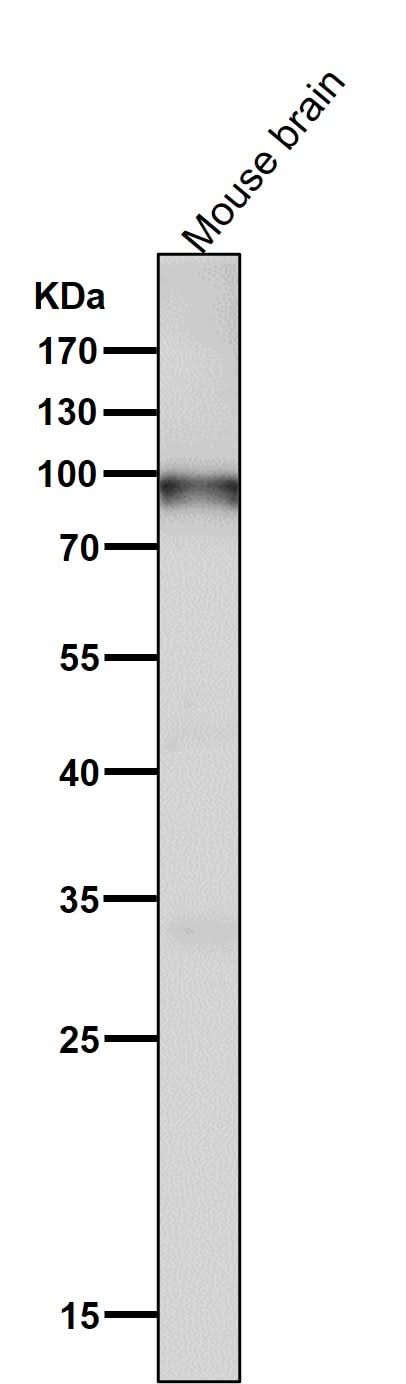 Anti-UBF1 Rabbit Monoclonal Antibody Boster Bio