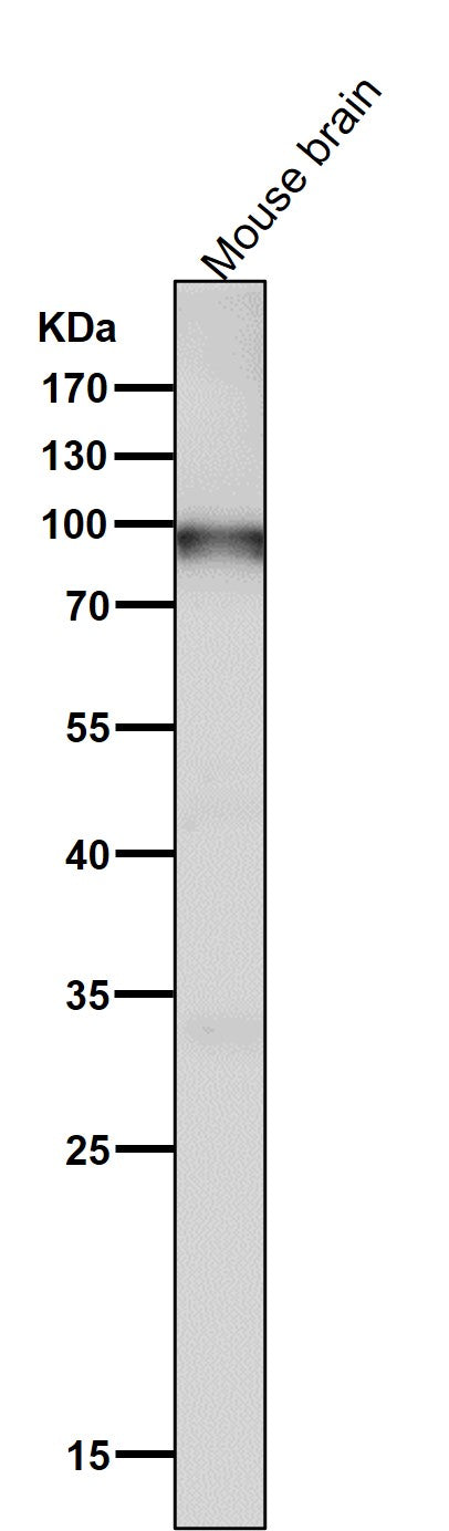 Anti-UBF1 Rabbit Monoclonal Antibody Boster Bio