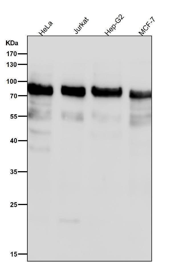 Anti-Phospho-UBF1 (S484) Rabbit Monoclonal Antibody Boster Bio