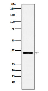 Anti-DCR2 Rabbit Monoclonal Antibody Boster Bio