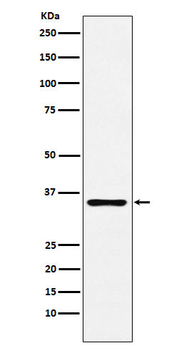 Anti-DCR2 Rabbit Monoclonal Antibody Boster Bio