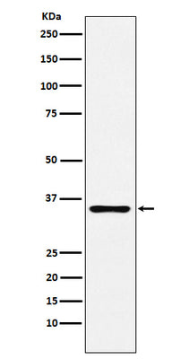 Anti-DCR2 Rabbit Monoclonal Antibody Boster Bio