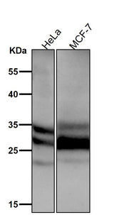 Anti-Caspase-14 Rabbit Monoclonal Antibody Boster Bio