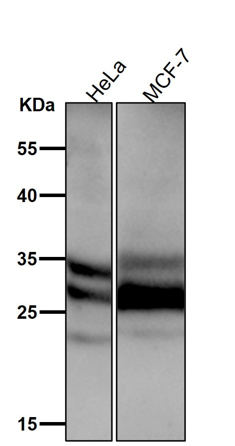 Anti-Caspase-14 Rabbit Monoclonal Antibody Boster Bio