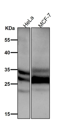 Anti-Caspase-14 Rabbit Monoclonal Antibody Boster Bio