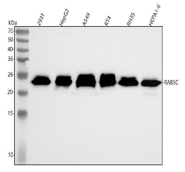 Anti-RAB5C / RABL Rabbit Monoclonal Antibody Boster Bio