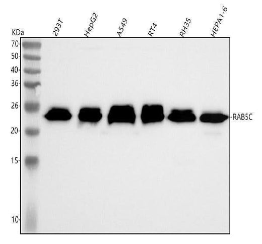 Anti-RAB5C / RABL Rabbit Monoclonal Antibody Boster Bio