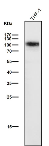 Anti-SIRP alpha Rabbit Monoclonal Antibody Boster Bio