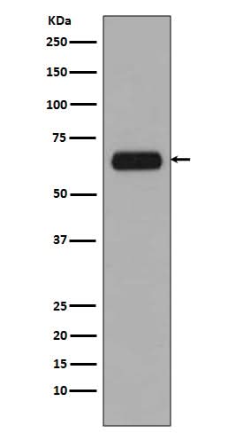 Anti-TCF3 TCF7L1 Rabbit Monoclonal Antibody Boster Bio
