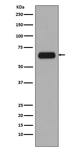 Anti-TCF3 TCF7L1 Rabbit Monoclonal Antibody Boster Bio