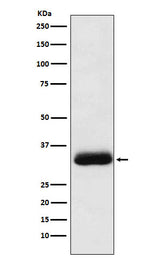 Anti-Alpha SNAP Rabbit Monoclonal Antibody Boster Bio