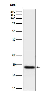 Anti-TNFAIP8 Rabbit Monoclonal Antibody Boster Bio
