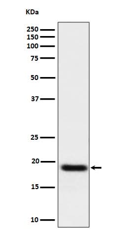 Anti-TNFAIP8 Rabbit Monoclonal Antibody Boster Bio