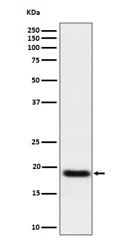 Anti-TNFAIP8 Rabbit Monoclonal Antibody Boster Bio