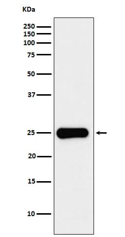 Anti-Placental lactogen Rabbit Monoclonal Antibody Boster Bio