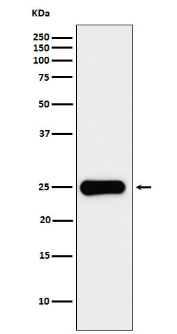 Anti-Placental lactogen Rabbit Monoclonal Antibody Boster Bio