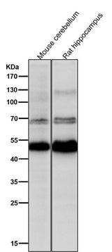 Anti-CHX10 Rabbit Monoclonal Antibody Boster Bio